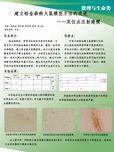 建立帕金森大鼠模型方法的改進(jìn)——雙位點(diǎn)注射建模