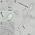 我國部分省份番茄白粉病菌的鑒定及其分子系統(tǒng)學(xué)研究