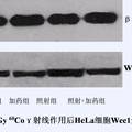 青蒿素對(duì)人宮頸癌HeLa細(xì)胞輻射增敏作用的研究