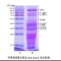 雞蛋黃中高磷蛋白制備工藝條件的研究