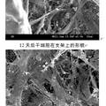 新型膽管仿生支架的實(shí)驗(yàn)研究