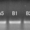 針?biāo)幉⒂脤渭冃苑逝执笫笱迨菟丶跋虑鹉XNPY基因表達(dá)的影響