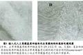 植入式人工角膜基質(zhì)及其制備方法