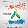 常用化療方案對(duì)原代乳癌細(xì)胞抑制率與基因過(guò)表達(dá)的相關(guān)性研究