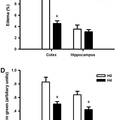 低氧預(yù)適應(yīng)減輕腦中動(dòng)脈阻塞所致小鼠缺血性腦損傷