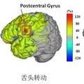 基于顱內腦電的高精度腦功能映射與神經監(jiān)護系統(tǒng)