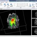 基于擴(kuò)散張量成像的腦白質(zhì)纖維三維重建算法研究與軟件開發(fā)