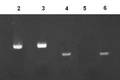 柯薩奇病毒B組3型感染胰島細(xì)胞的體外研究