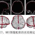 基于顱內腦電的高精度腦功能映射與神經監(jiān)護系統(tǒng)