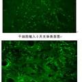 新型膽管仿生支架的實(shí)驗(yàn)研究